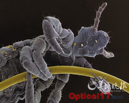 显微镜下的虱子图片