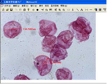 细胞测量图片