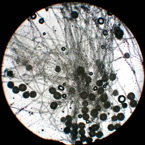 显微镜下的霉菌