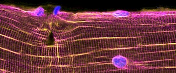 科学家发现肌肉再生的新机制