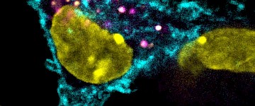 对抗肿瘤的隐匿方法：伪装成癌细胞的免疫细胞