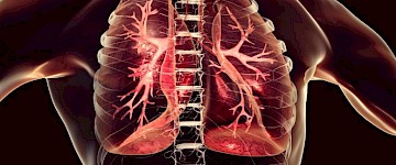 COVID-19 病理学的新细胞图谱揭示了冠状病毒如何在肺部造成严重破坏